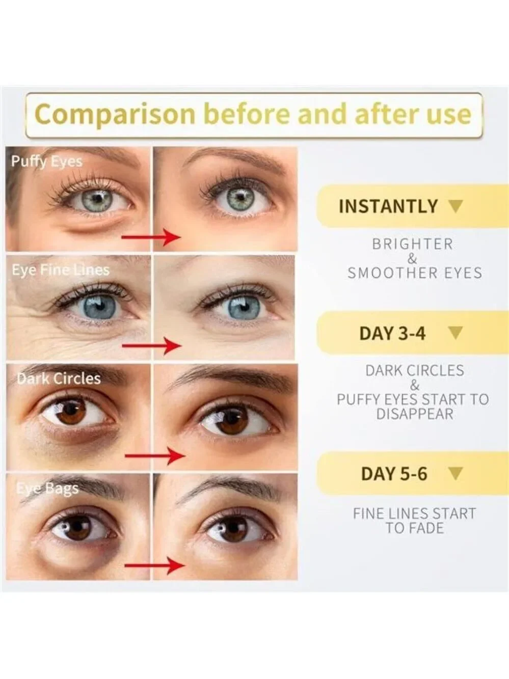 24K Gold Under Eye Patches 60 Pack for Puffy Eyes, Dark Circles, Bags & Wrinkles